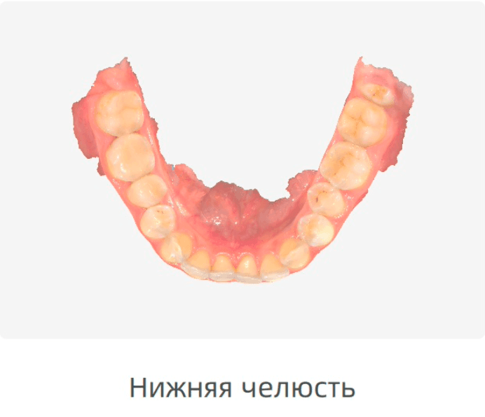 Сканер нижней челюсти