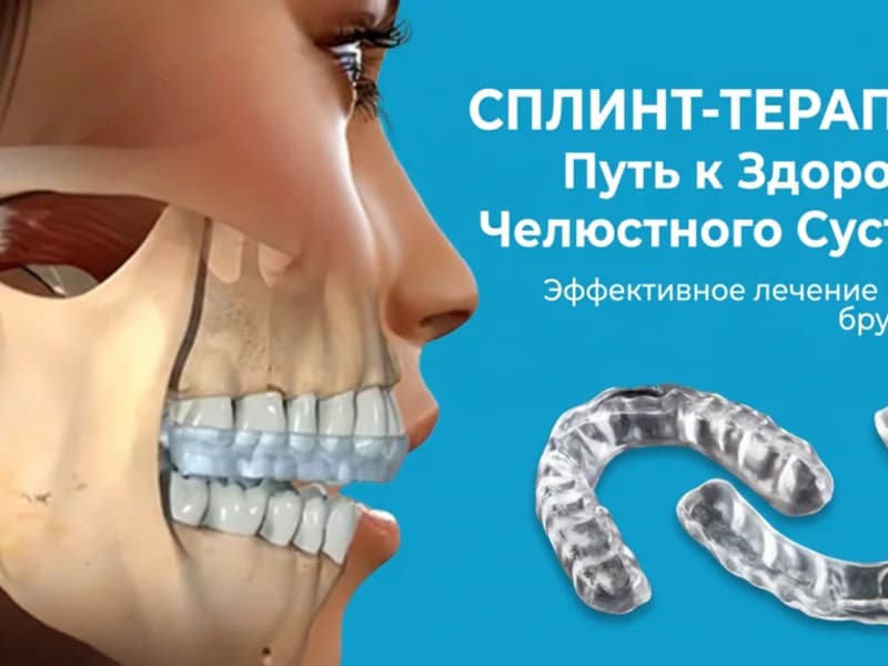 сплинт терапия клиника тидент